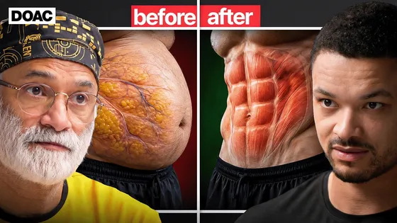 Pradip Jamnadas says belly fat can signal 10 years of high insulin before diabetes